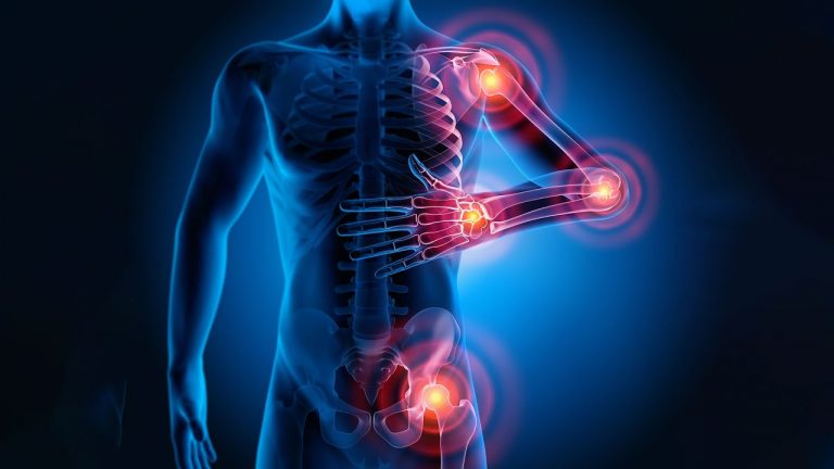 Infektionen & rheumatische Erkrankungen