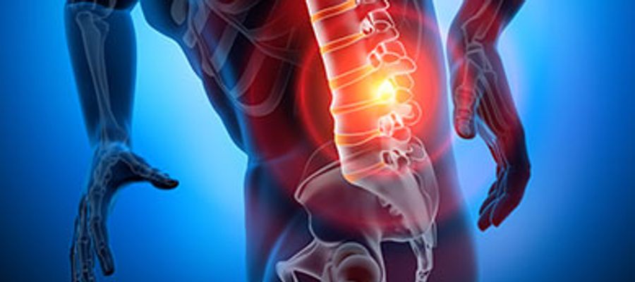 Anatomische Abbildung Schmerzen unterer Lendenbereich