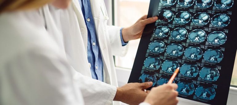 Frau zeigt auf Foto des MRT vom Gehirn