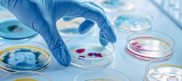 Laboruntersuchung reagenzschalen